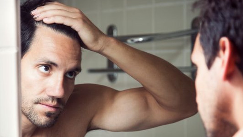 Sac Dokulmesinin Nelen Olur Iste Sac Dokulmesinin 9 Nedeni Saglik Haberleri Ntv