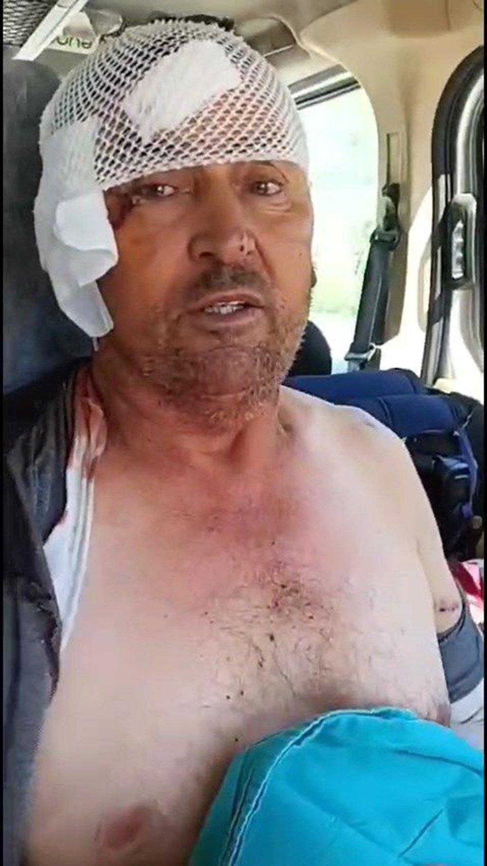 Manavgat'ta firari aslanla boğuşan adam anlattı: Bir anda üstüme çöktü - 10