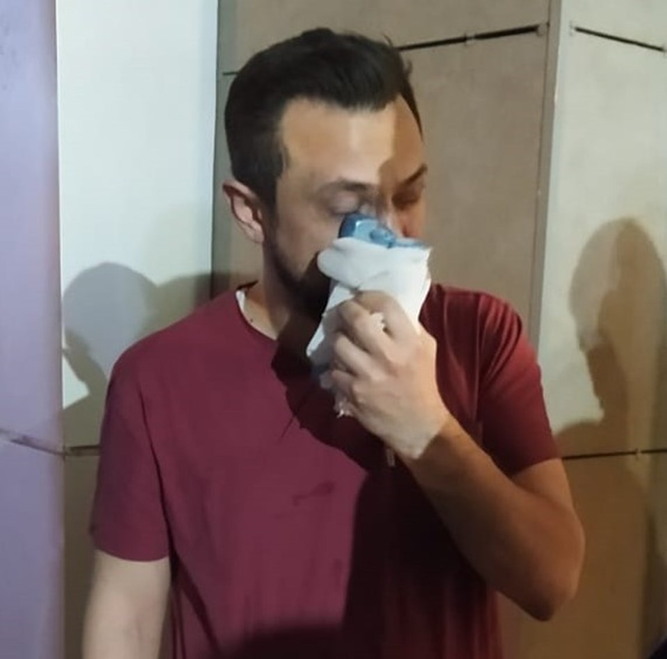 Şanlıurfa’da saldırıya uğrayan doktorun burnu kırıldı - 1