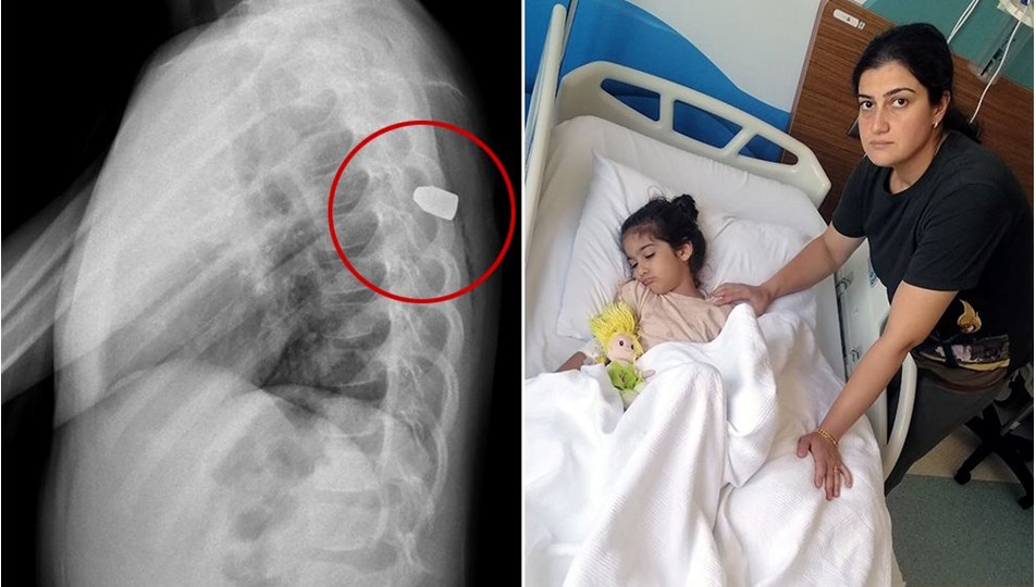 Site bahçesinde oynarken yorgun mermi isabet etti: Böcek ısırığı sandı - Son Dakika Türkiye Haberleri | NTV Haber