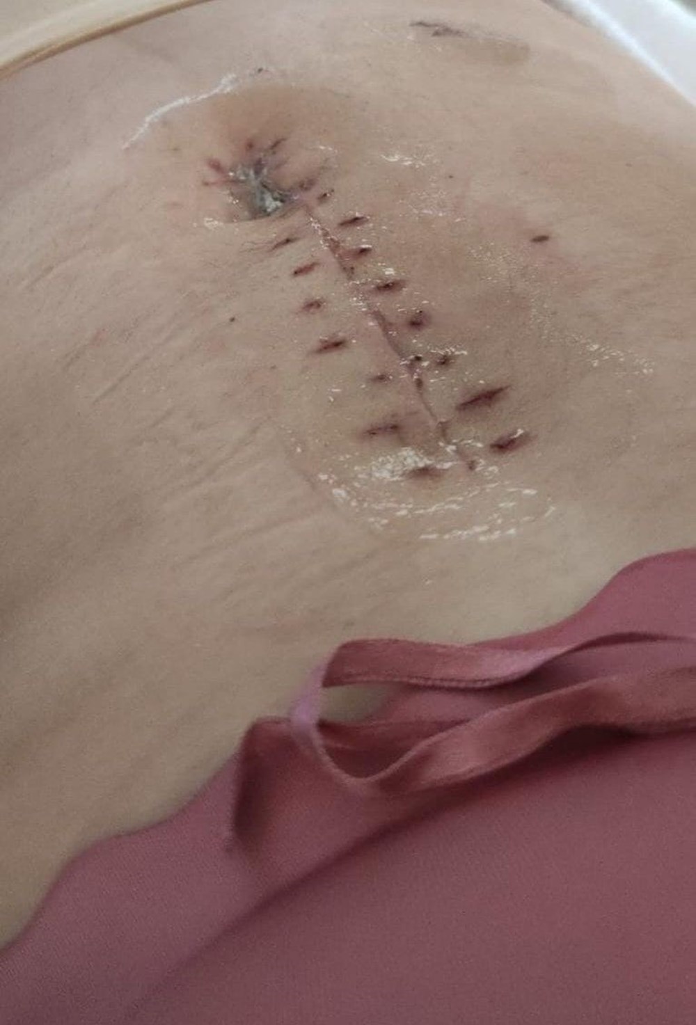 Ekmek bıçağı ile 7 yerinden bıçaklanan Sinem'in eski eşine 9 ayda tahliye: Korunma talebi reddedildi - 4