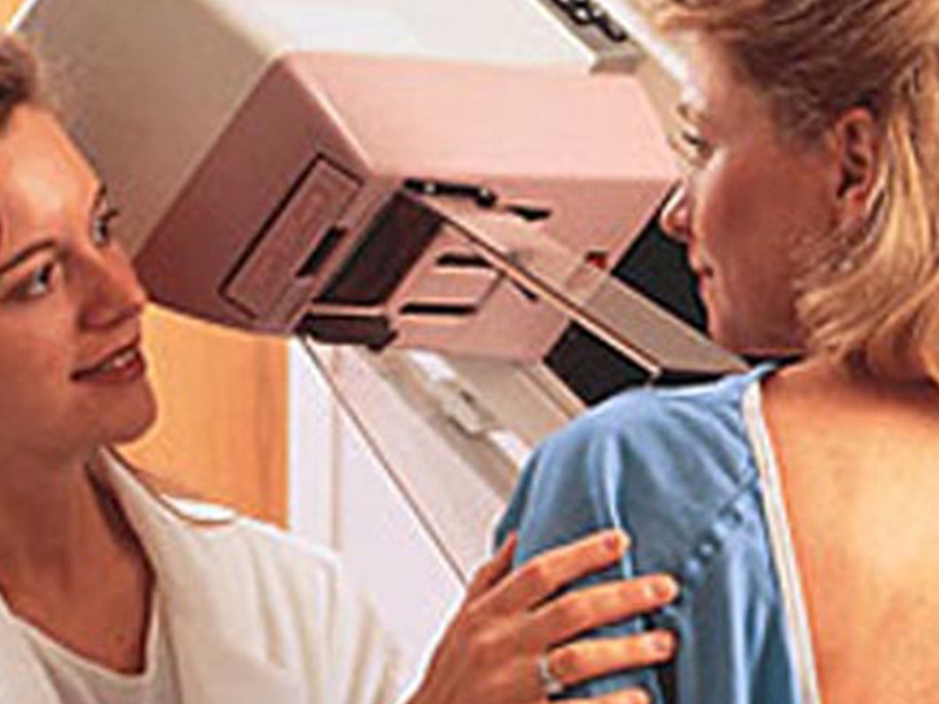 Bursali Kadinlara Ucretsiz Mamografi Saglik Haberleri Ntv