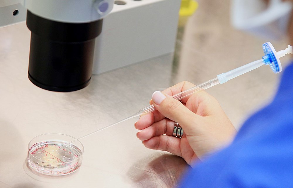 Dünyanın birinci sperm nakli: İhtilal niteliğinde bir tedavi olabilir 77 4XIKUrDq00myJFipkTvLbA