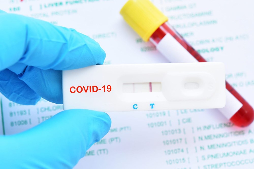 corona virusu tespit etmek icin gelistirilen ev tipi antikor testi nedir ve ne zaman kullanilabilir saglik haberleri ntv