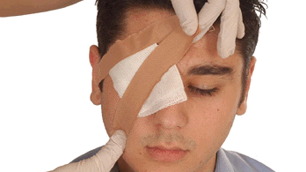 Yanlis Mudahale Korluge Neden Olabilir Saglik Haberleri Ntv