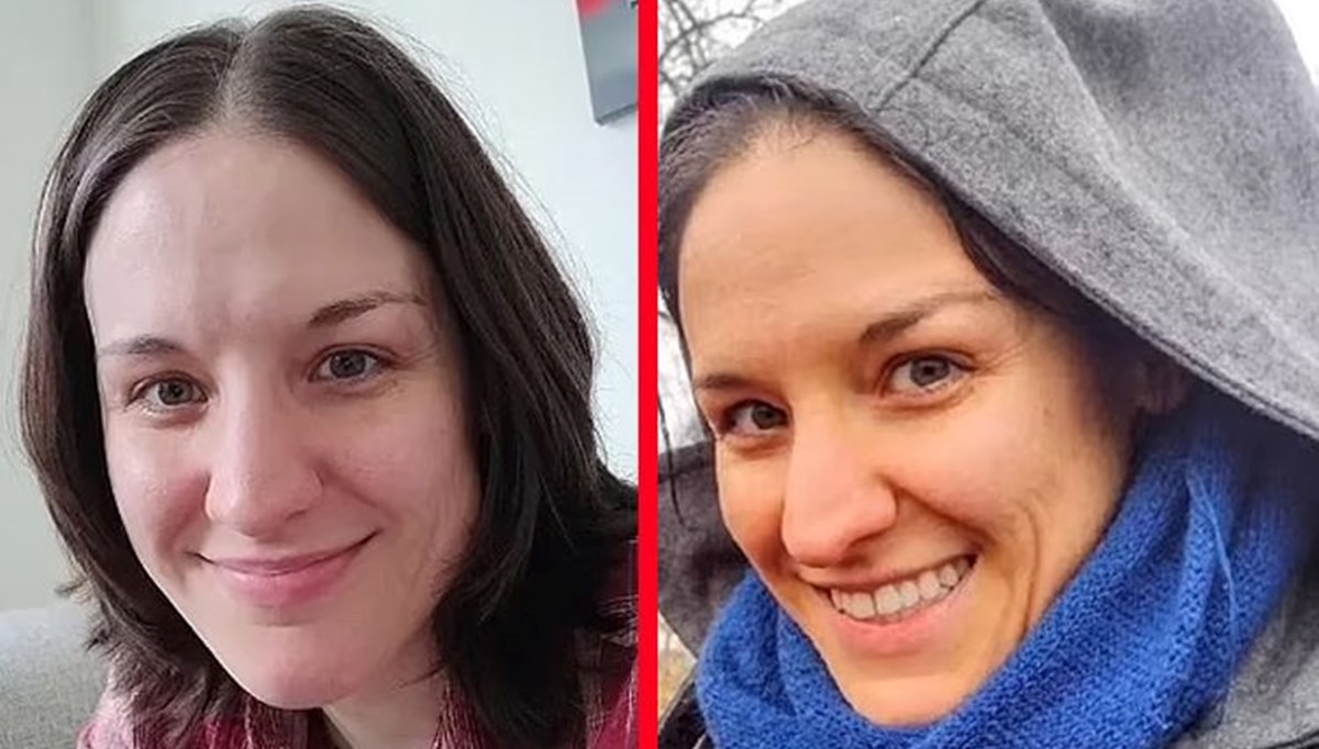 Çok fazla havuç yemenin endişelendiren etkisi: Yüzü renk değiştirmeye başladı