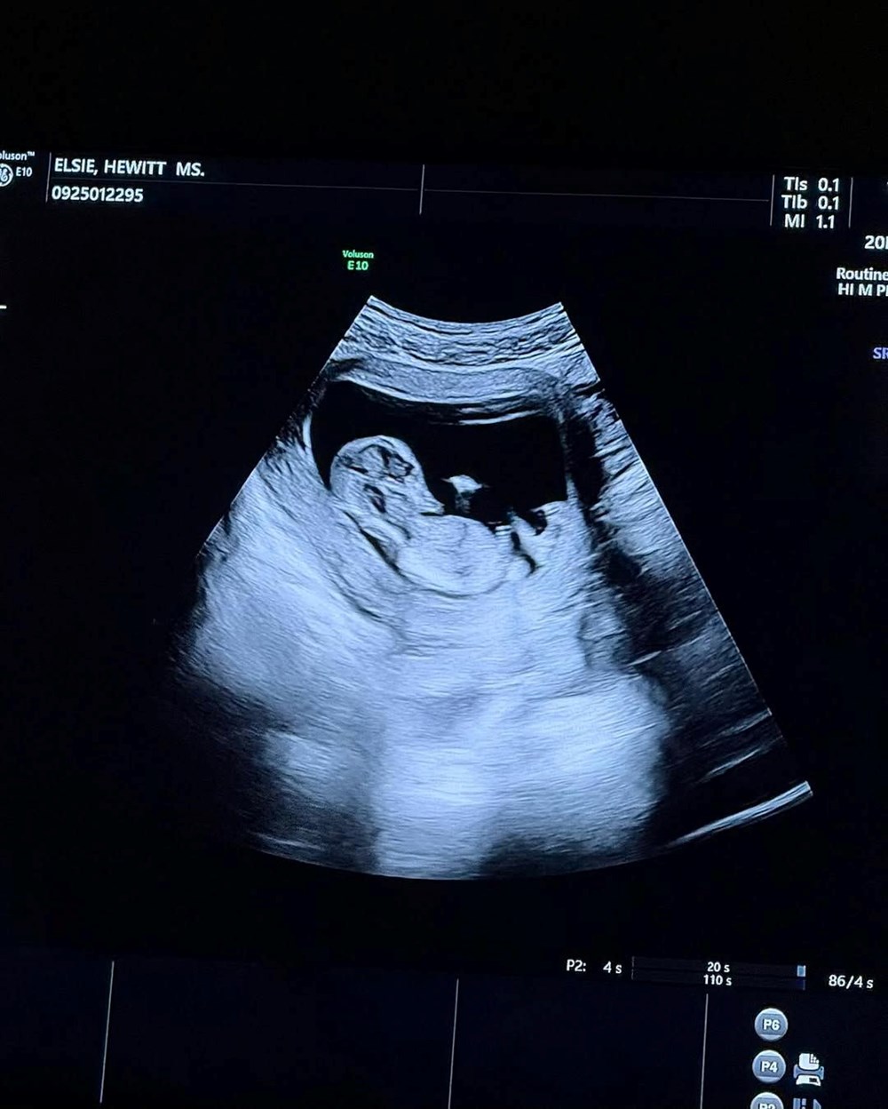 Oyuncu Pete Davidson baba oluyor - 3