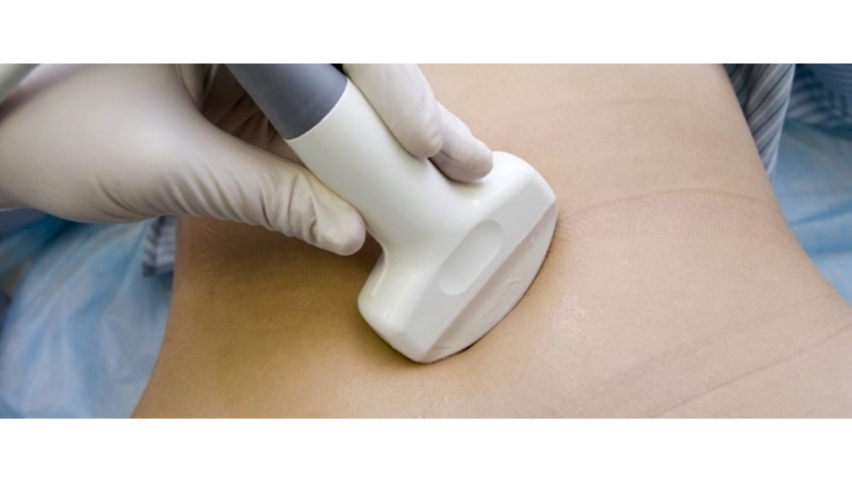 Gebelik 4 Haftada Anlasilmaz Saglik Haberleri Ntv