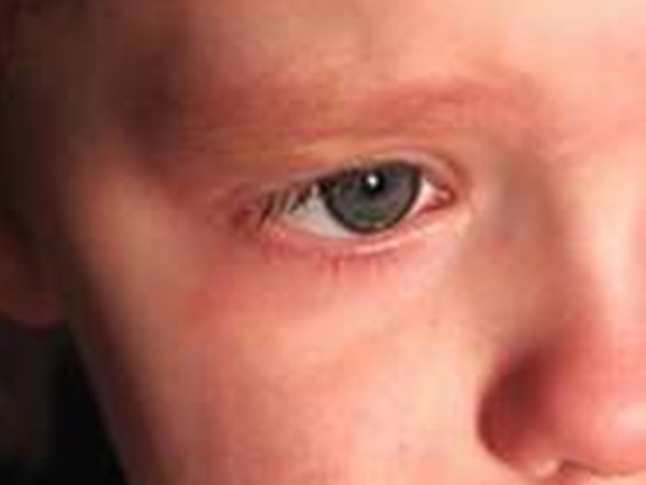 Psikolojisi Bozulan Cocuk Nasil Anlasilir Saglik Haberleri Ntv