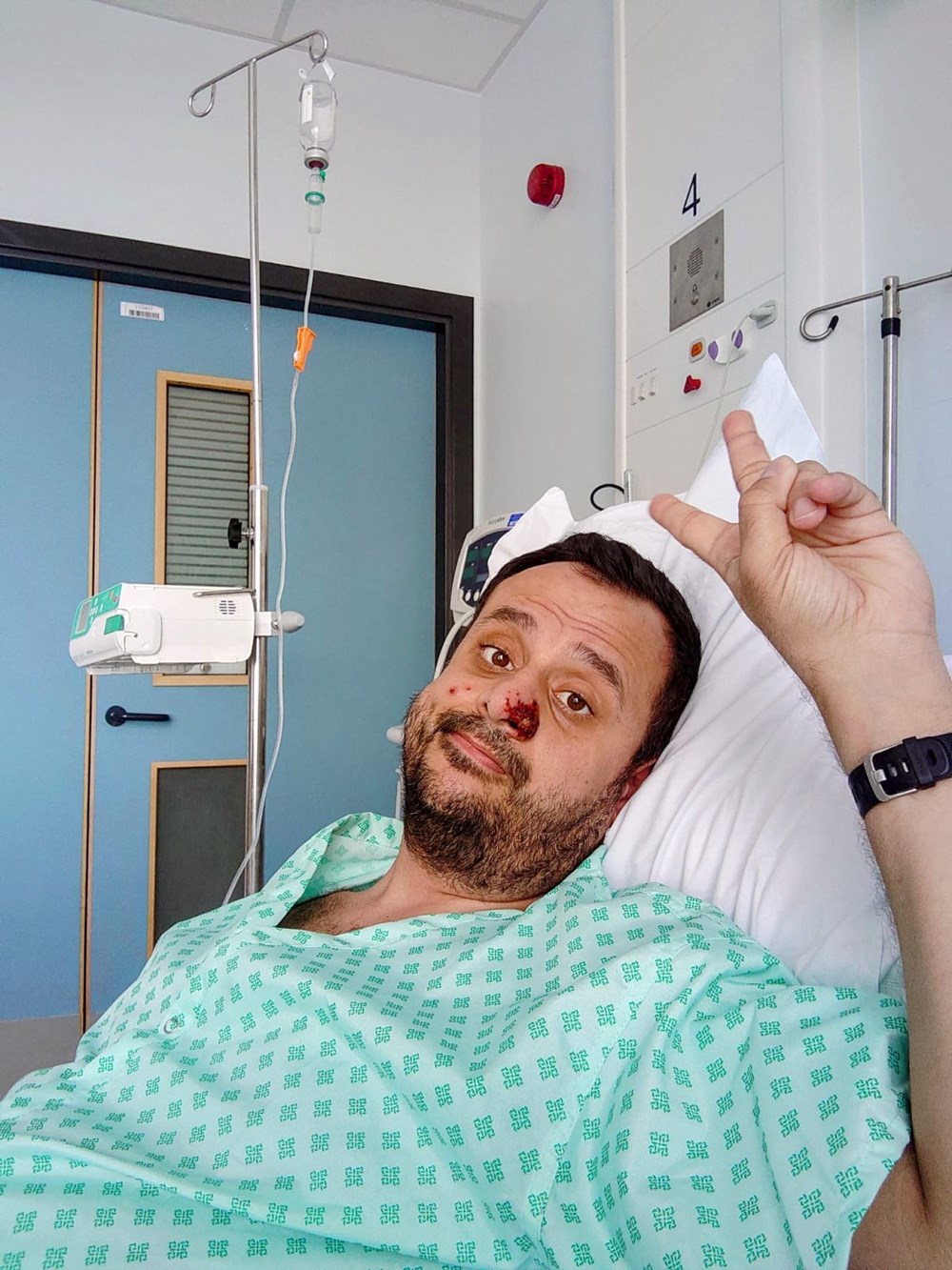 Dünyanın konuştuğu hasta: Önce HIV ve Covid sonra da maymun çiçeği - 9