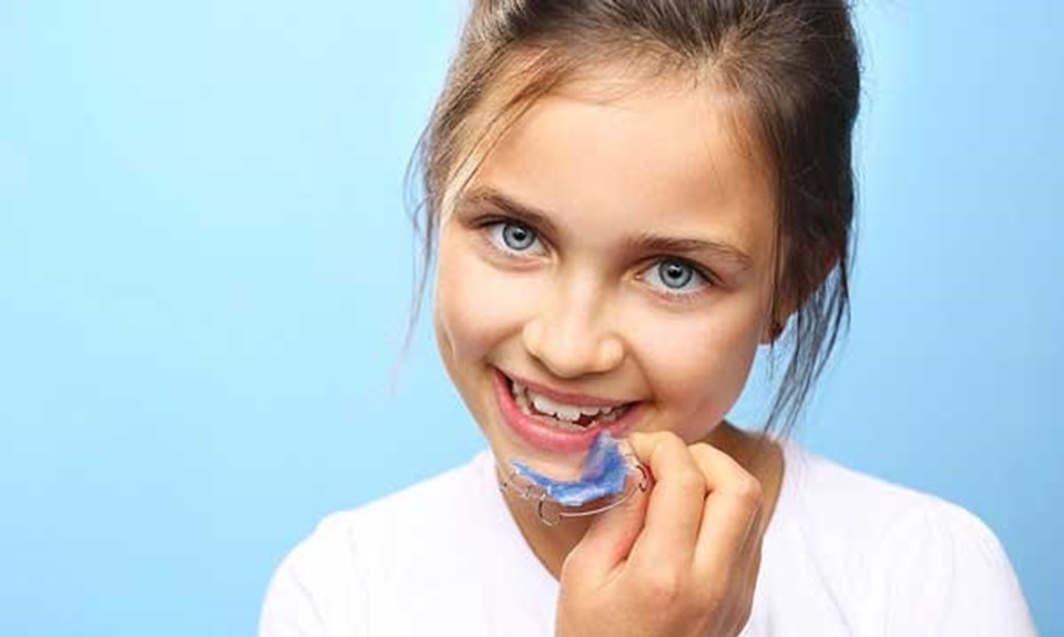 Ortodontik tedavi için kalıcı dişlerin çıkmasını beklemeyin! - 2