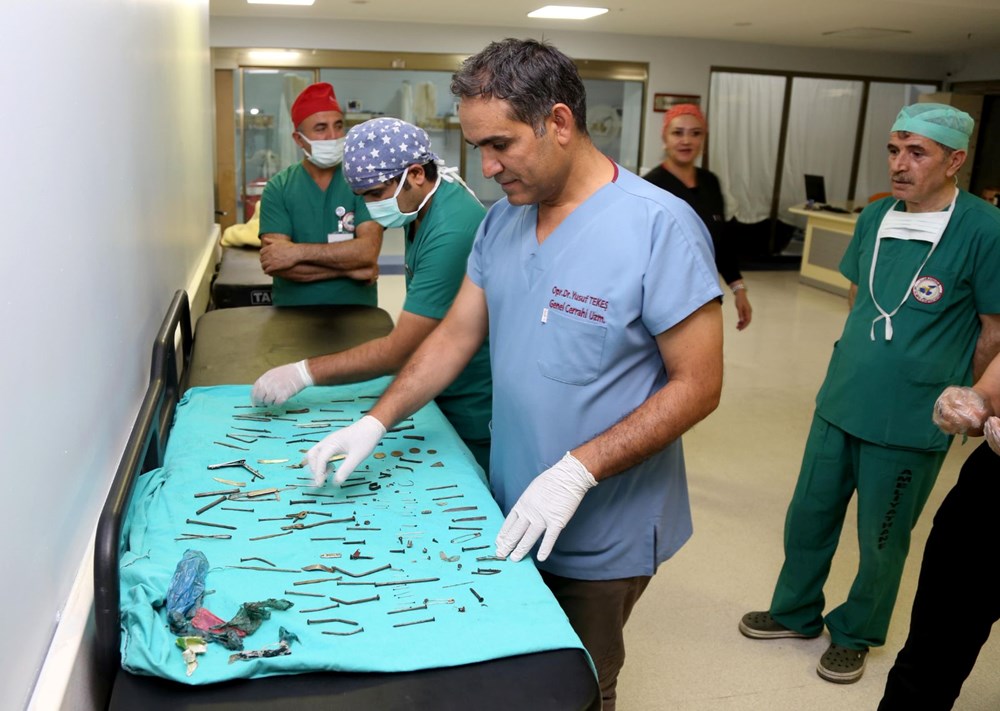 Van'da kadın hastanın midesinden 158 yabancı cisim çıkarıldı - 3