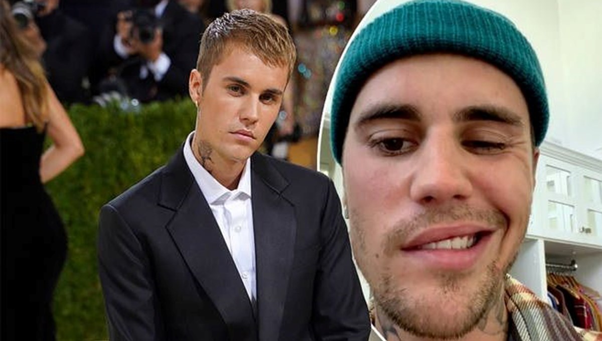 Justin Bieber'ın hastalığı Ramsay Hunt sendromu nedir?