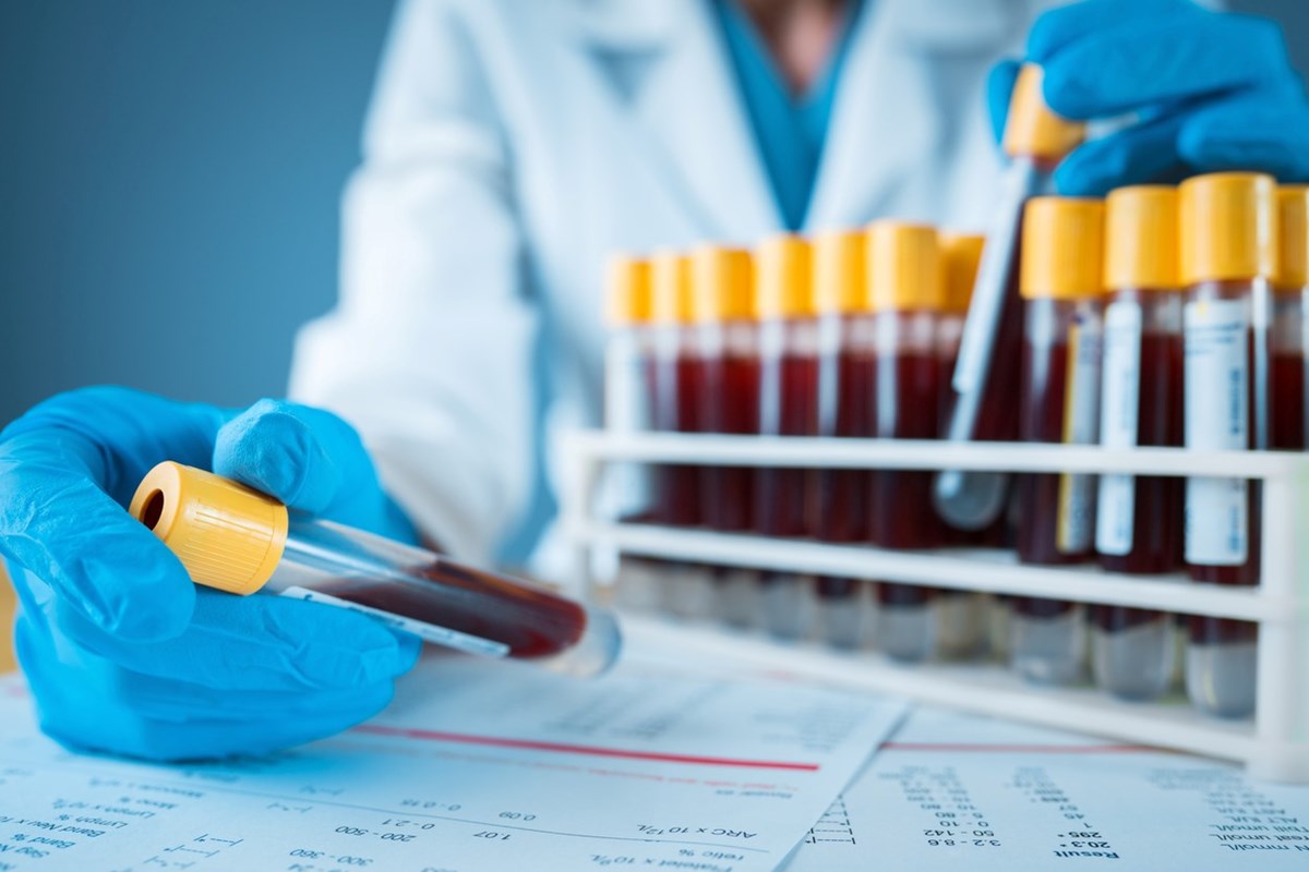 “Kutsal Kase” olarak adlandırılan test, semptomlar ortaya çıkmadan önce 50