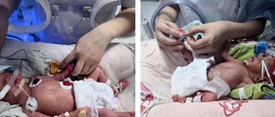 Çin’de bir kadın üç kez düşük yaptıktan sonra dördüz doğurdu - 1