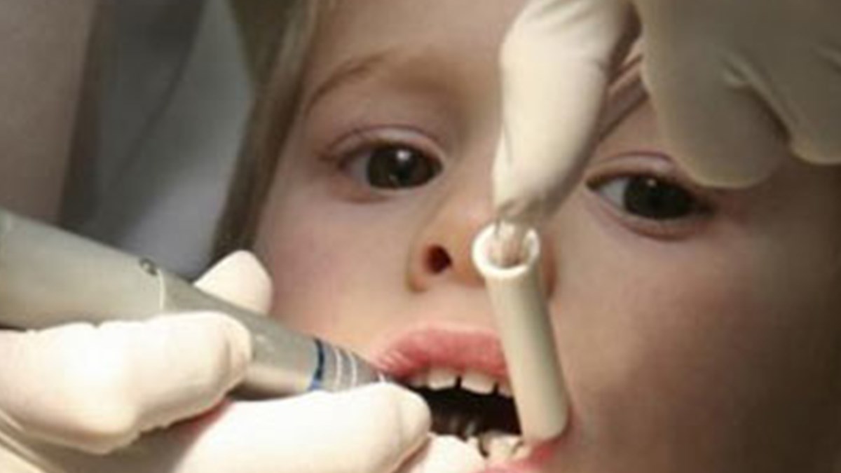 Cocuk Dis Tedavisinde Genel Anestezi Saglik Haberleri Ntv