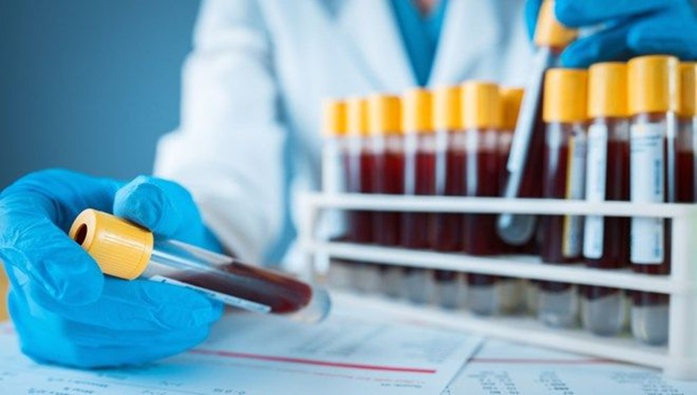 Kan grubu “0”
olanlar corona virüse karşı daha avantajlı: İki yeni çalışma destekledi - 7