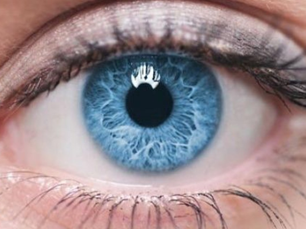 goz kanseri belirtilerine dikkat saglik haberleri ntv