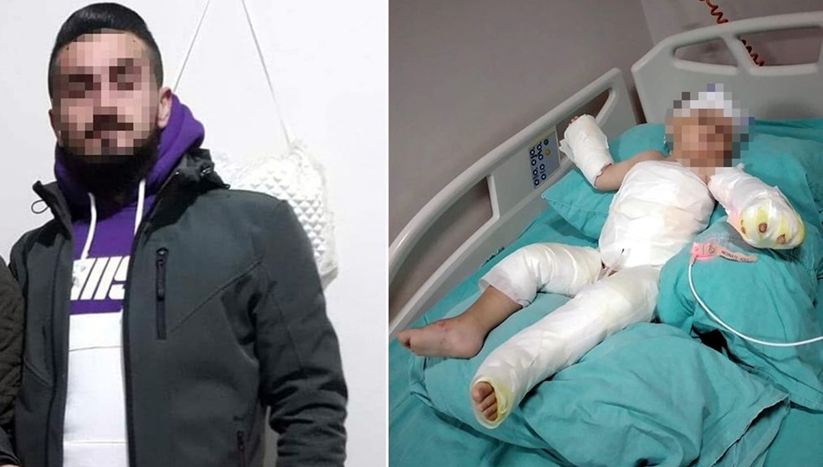 Eşi ve oğlunu kolonya dökerek yaktı
