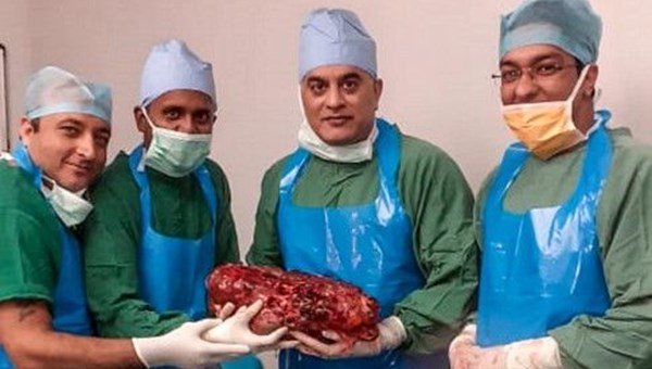 Hindistan'da 7,4 kilogramlık böbrek alındı