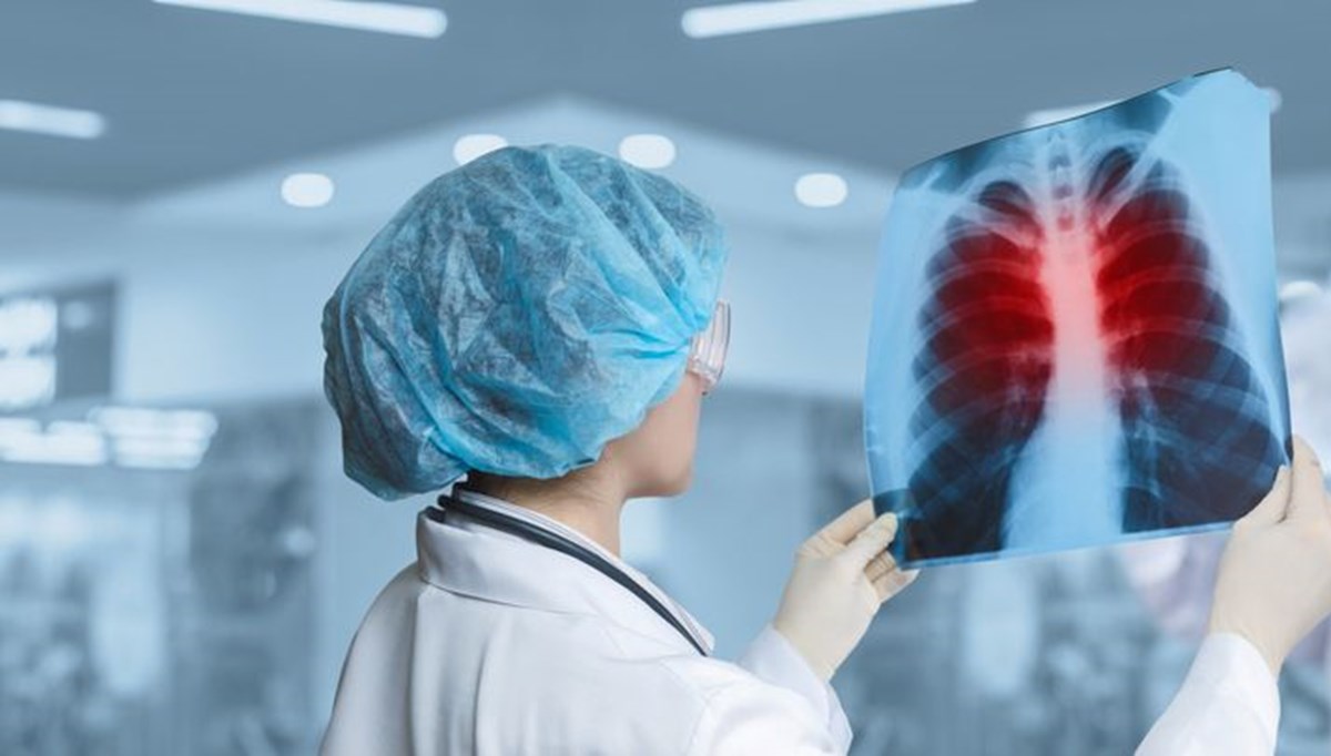 Tehlike sinyali veren 8 zatürre belirtisi