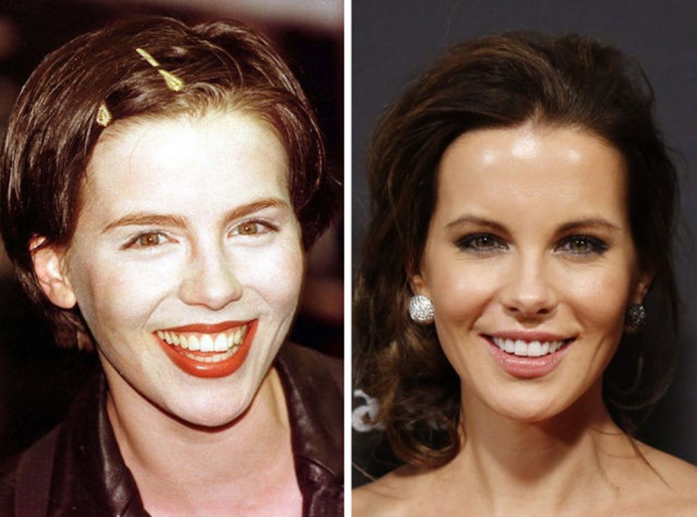 Pin by NKT23 on KATE BECKINSALE Kate beckinsale, Kate beckinsale plastic surgery