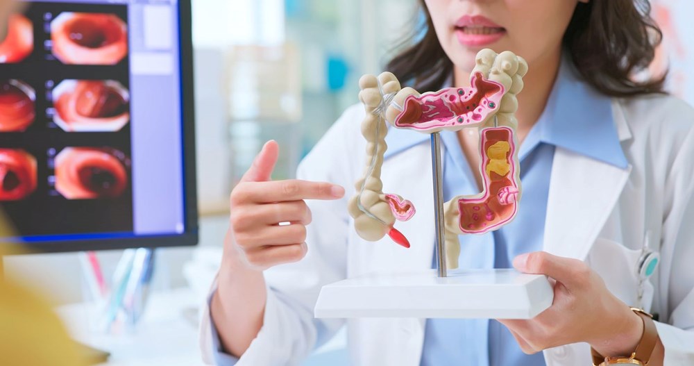 Bağırsak kanseri neden arttı? Gençler de risk altında - 3