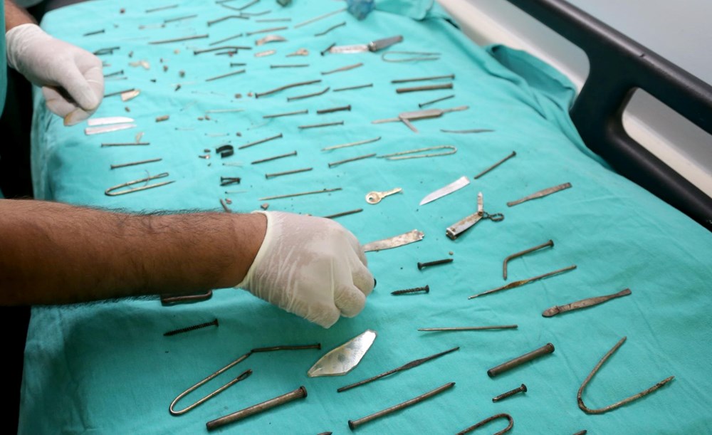 Van'da kadın hastanın midesinden 158 yabancı cisim çıkarıldı - 6