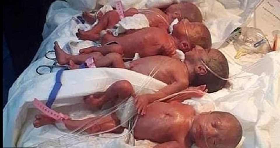 Malili kadın 9 çocuk dünyaya getirdi: 5'i kız 4'ü erkek - 1