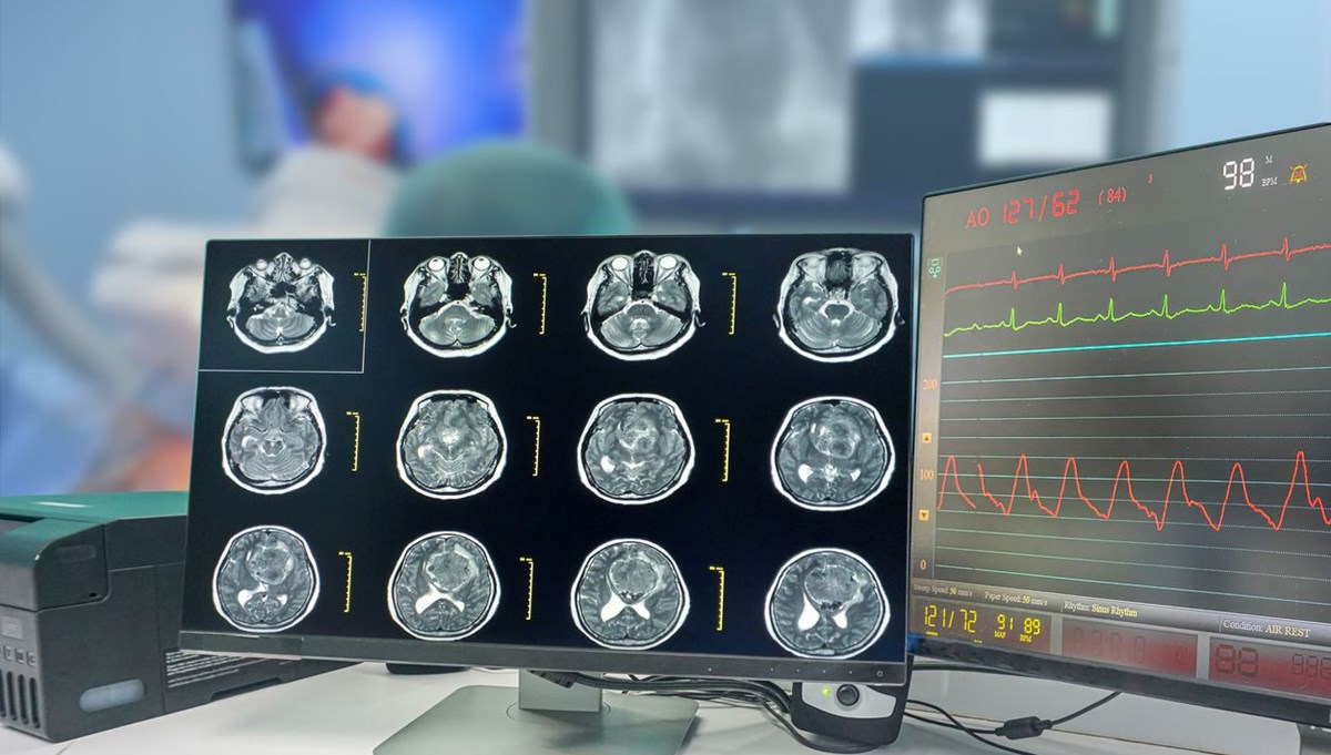 Beyin kanserine karşı implant geliştirildi: Her yıl 200 bin insanın ölümü önlenebilir