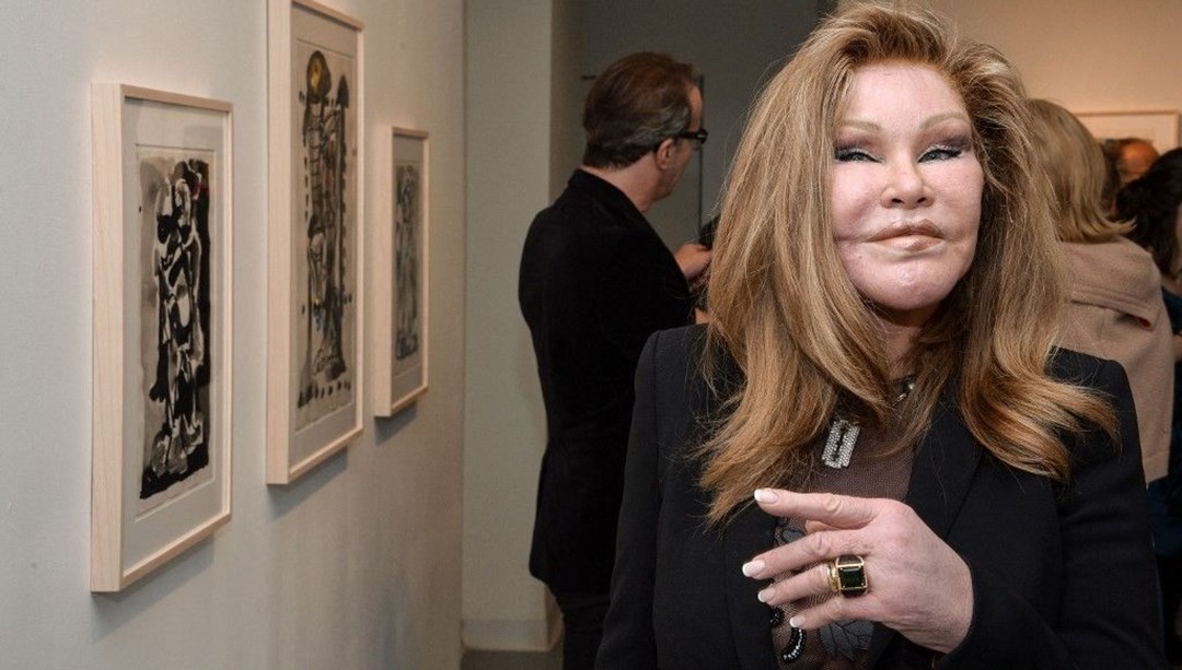 Kedi kadın Jocelyn Wildenstei estetik masrafları yüzünden iflas etti