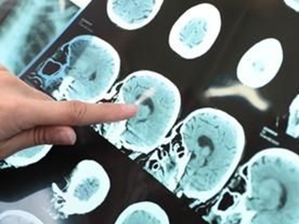 asiri terleme zor durumda birakiyor