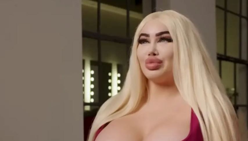 Sosyal medya fenomeni estetik operasyonlara 10 milyon lira harcadı: Neredeyse ölüyordum