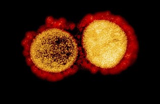 'Çift mutant' corona virüs varyantı ABD’ye sıçradı