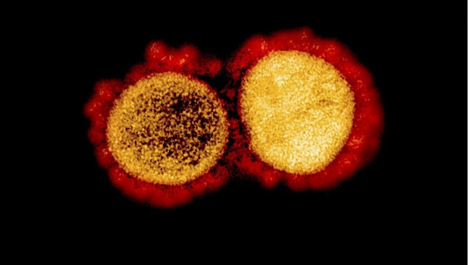 'Çift mutant' corona virüs varyantı ABD’ye sıçradı