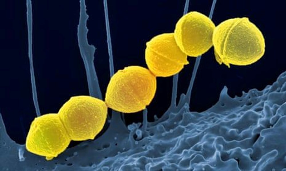 Strep A 9 çocuğu öldürdü: Küresel endişeye neden olan Strep A nedir, belirtileri neler ve Türkiye'de görüldü mü? - 4