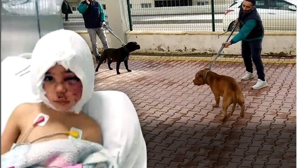 Pitbull saldırısında ağır yaralanan Asiye'nin hayati tehlikesi sürüyor