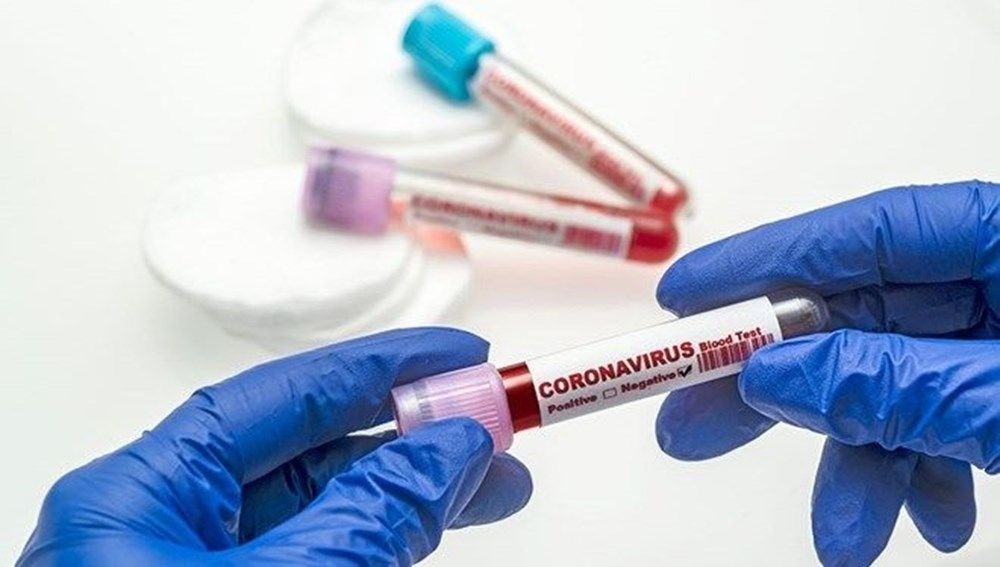 Corona virüs aşılarında son durum: Ağır hastalıktan ya da  ölümden koruyabileceklerine dair sonuç yok - 3