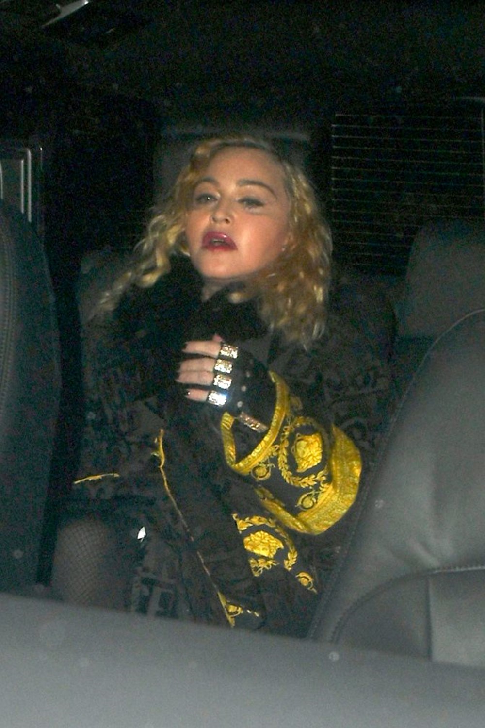 Madonna’nın son hali (Hastalık mı estetik mi?) Magazin Haberleri NTV