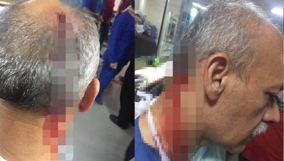 Elazığ'da doktora yumruklu saldırı