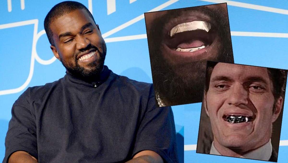 Kanye West gündemden düşmüyor: Titanyum dişleri dikkat çekti