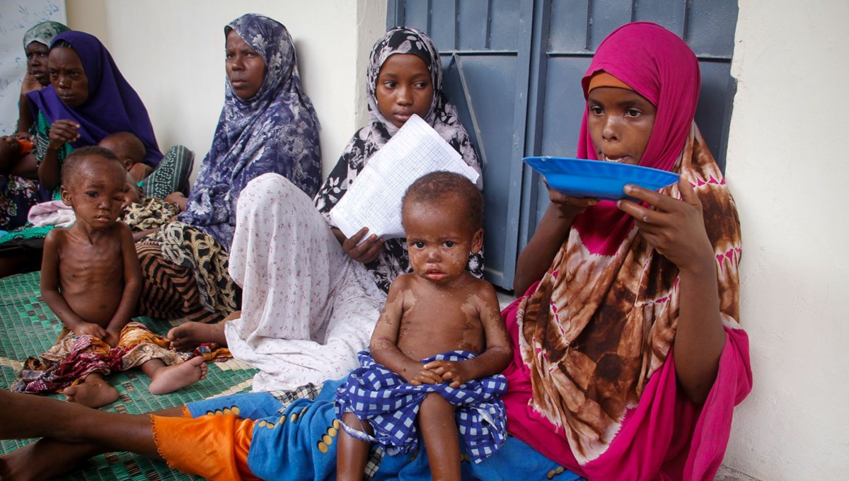 Somali'de 6 ayda en az 200 çocuk yetersiz beslenme nedeniyle öldü