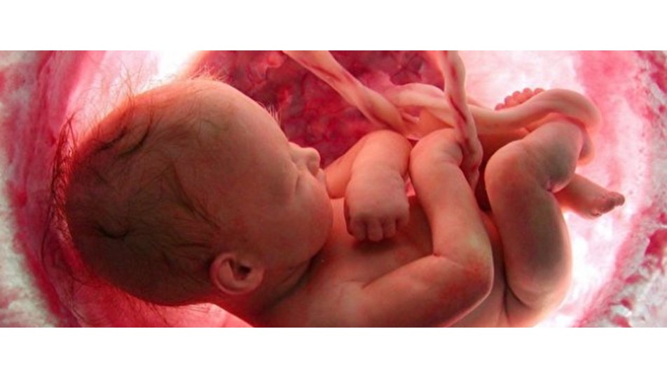 Anne karnında ameliyat Sağlık Haberleri NTV Anne karnında ameliyat Sağlık Haberleri NTV