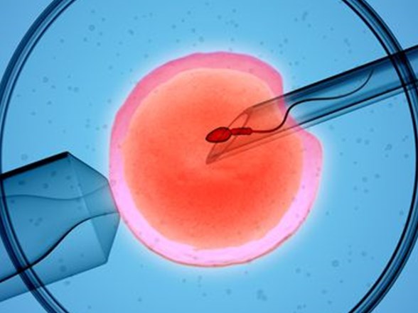embriyo kulturunden genetik tani tup bebek basarisini artirilabilir