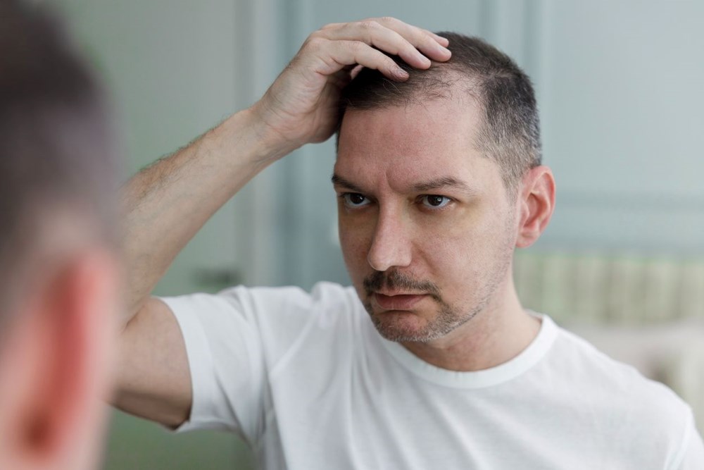 Saçlarınız mı dökülüyor? Gür saçların sırrı bu besinlerde saklı! 77