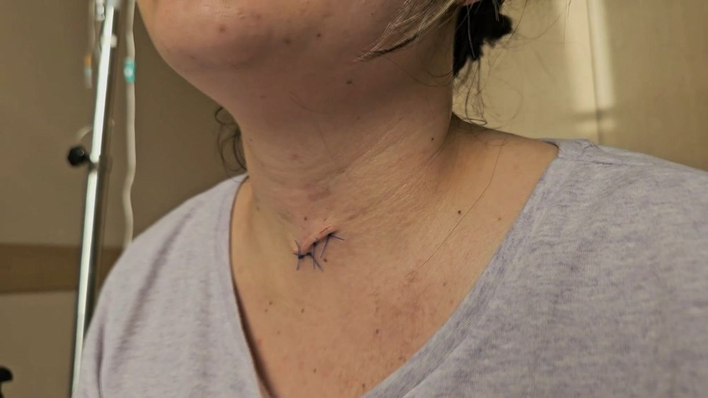 Defalarca bıçakladı, ölmesi için başında bekledi! Mucize kadın yaşadığı dehşeti anlattı - 6