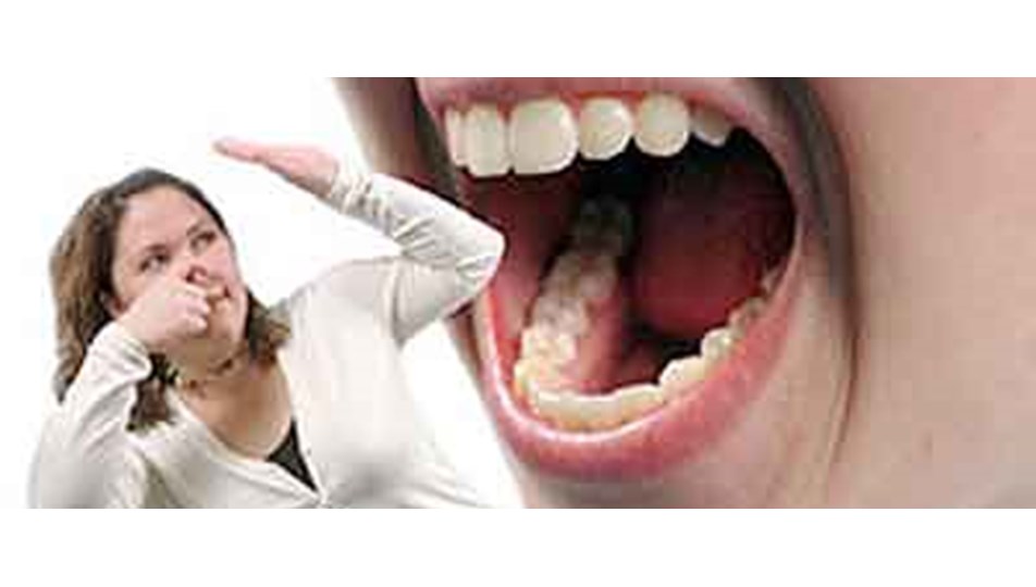 agiz kokusu na takilmayin saglik