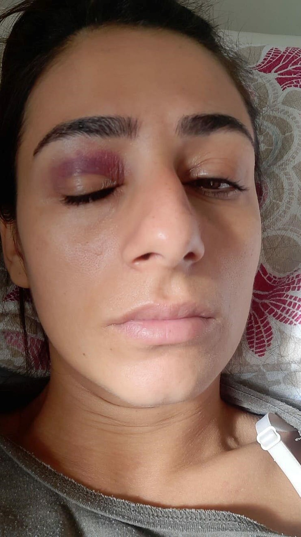 İzmir'de sokak ortasında taciz edilen kadın, karşı koyunca darp edildi - 2
