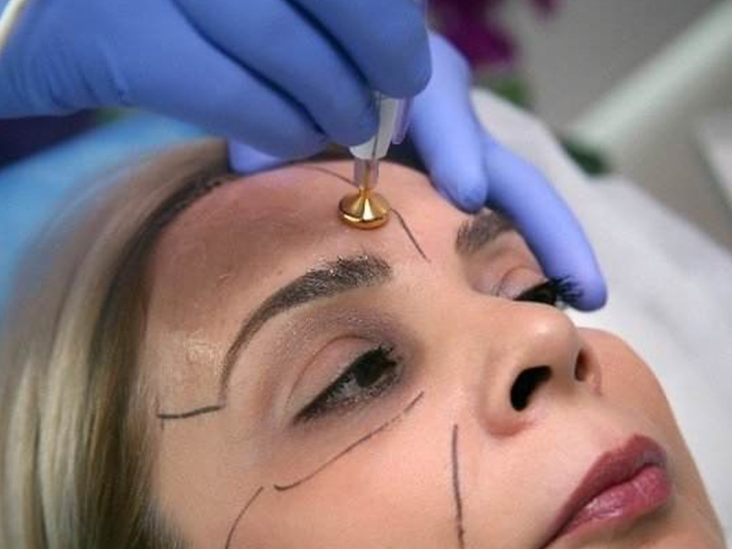 yuzdeki kirisikliklari utuleyerek