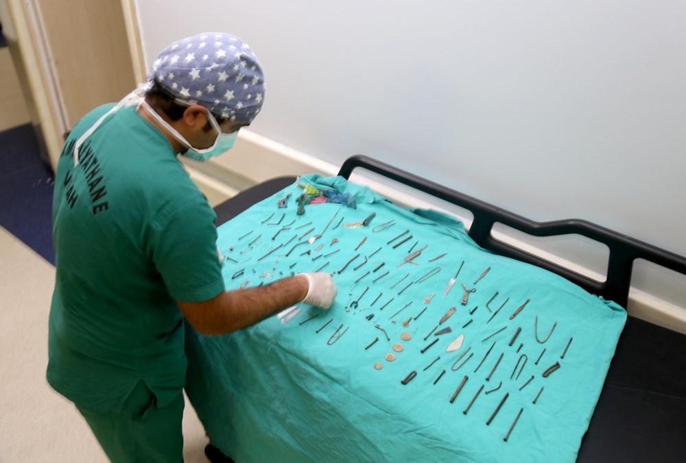 Van'da kadın hastanın midesinden 158 yabancı cisim çıkarıldı - 8